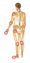 Pain points on the skeleton